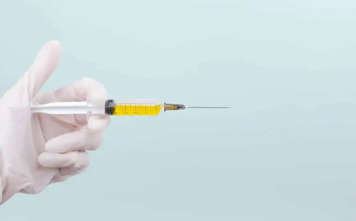 A PMMA injection